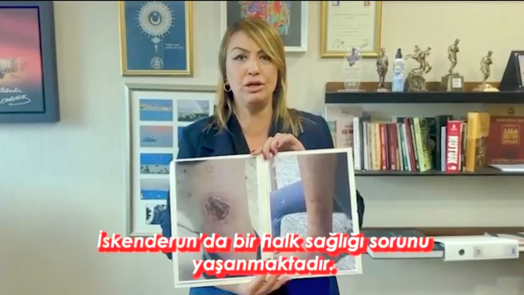 KARA:”Bir Şirket Para Kazanacak Diye İskenderun Halkının Sağlığı İle Oynamayın”